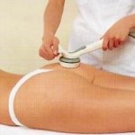 Cellulite treatment with ultrasound. Лечение целлюлита ультразвуком